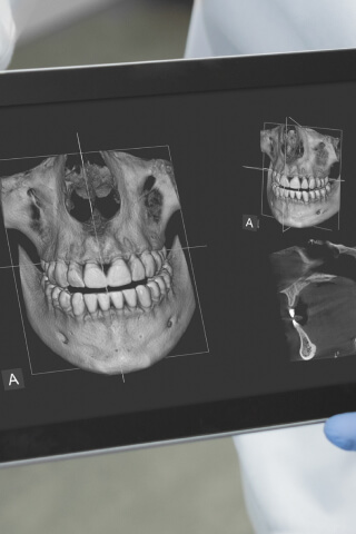 Digital dental x-rays