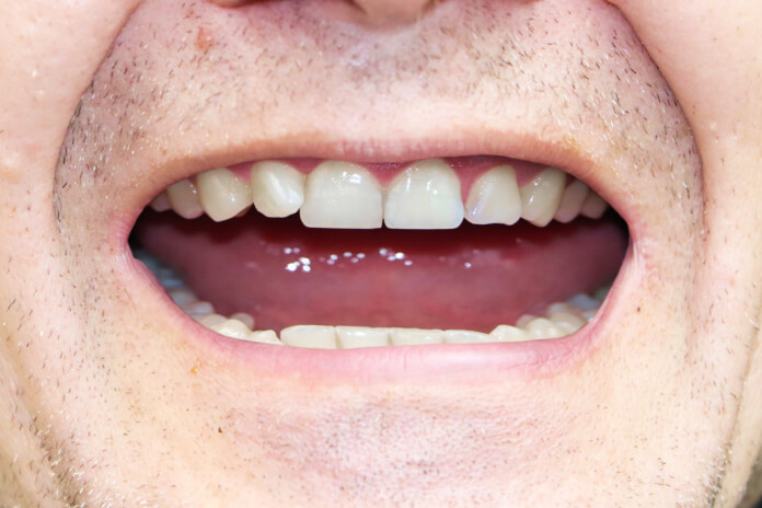 Patient smiles after receiving care from our Grundy Center, IA dentist